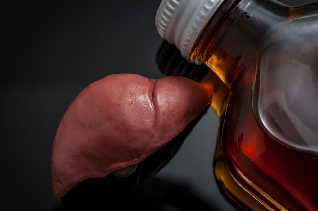 Model of human liver beside bottle of alcohol on dark background, symbolizing advanced alcohol hepatitis and risk of liver failure in Spokane, WA and across Washington State