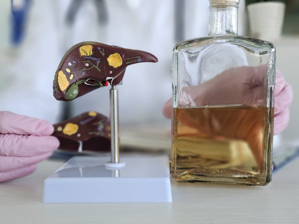 Doctor showing liver damage model beside alcohol bottle, effects of alcohol withdrawal in Spokane Valley, WA