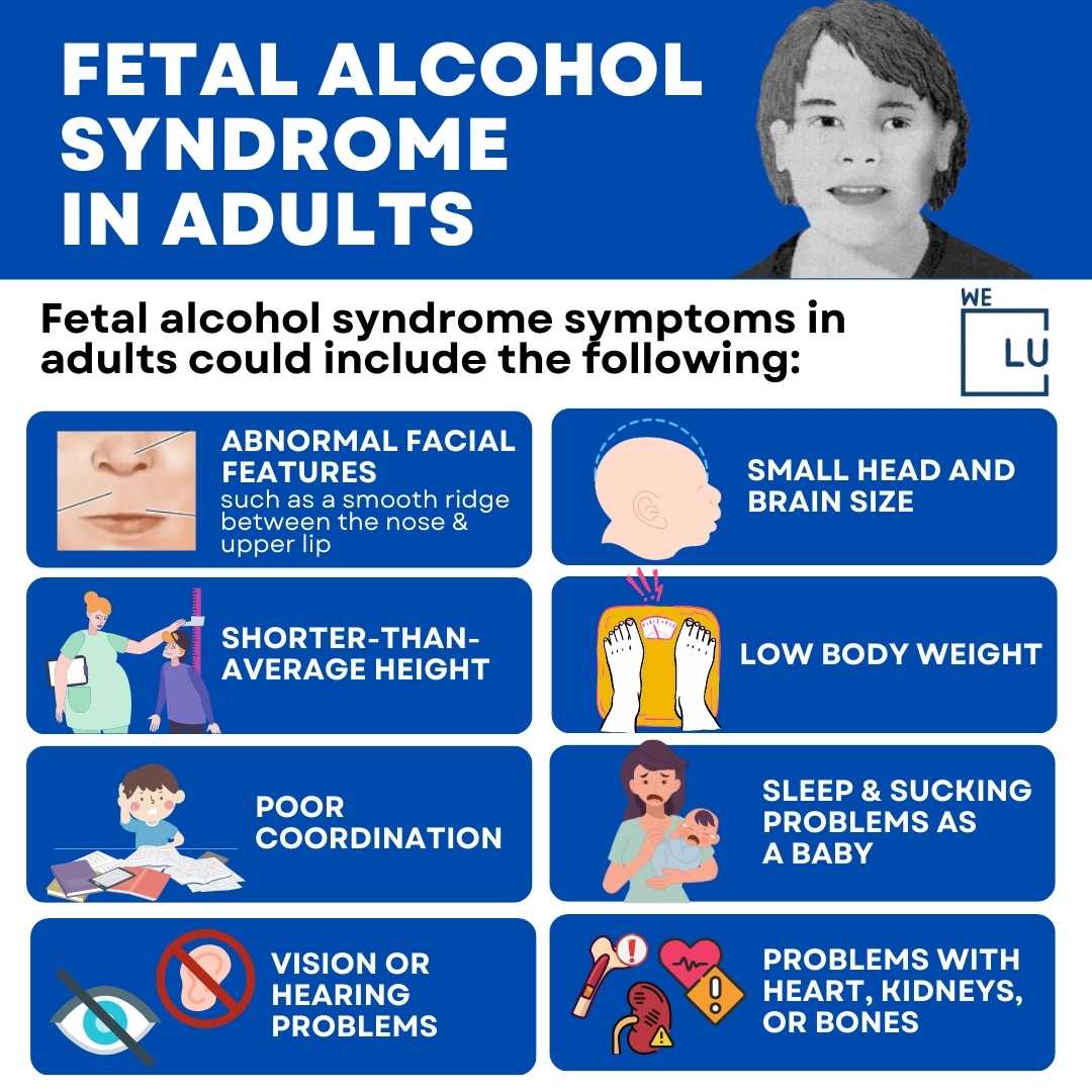 Fetal alcohol syndrome adult, Risk Factors, Alcoholism, Prevention