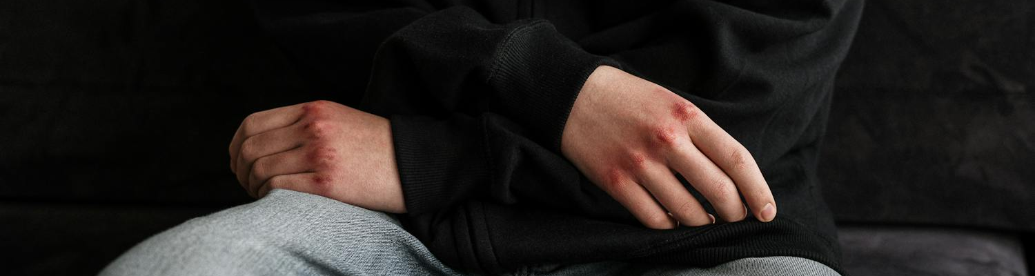 Visible consequences when someone is addicted to self harm. 