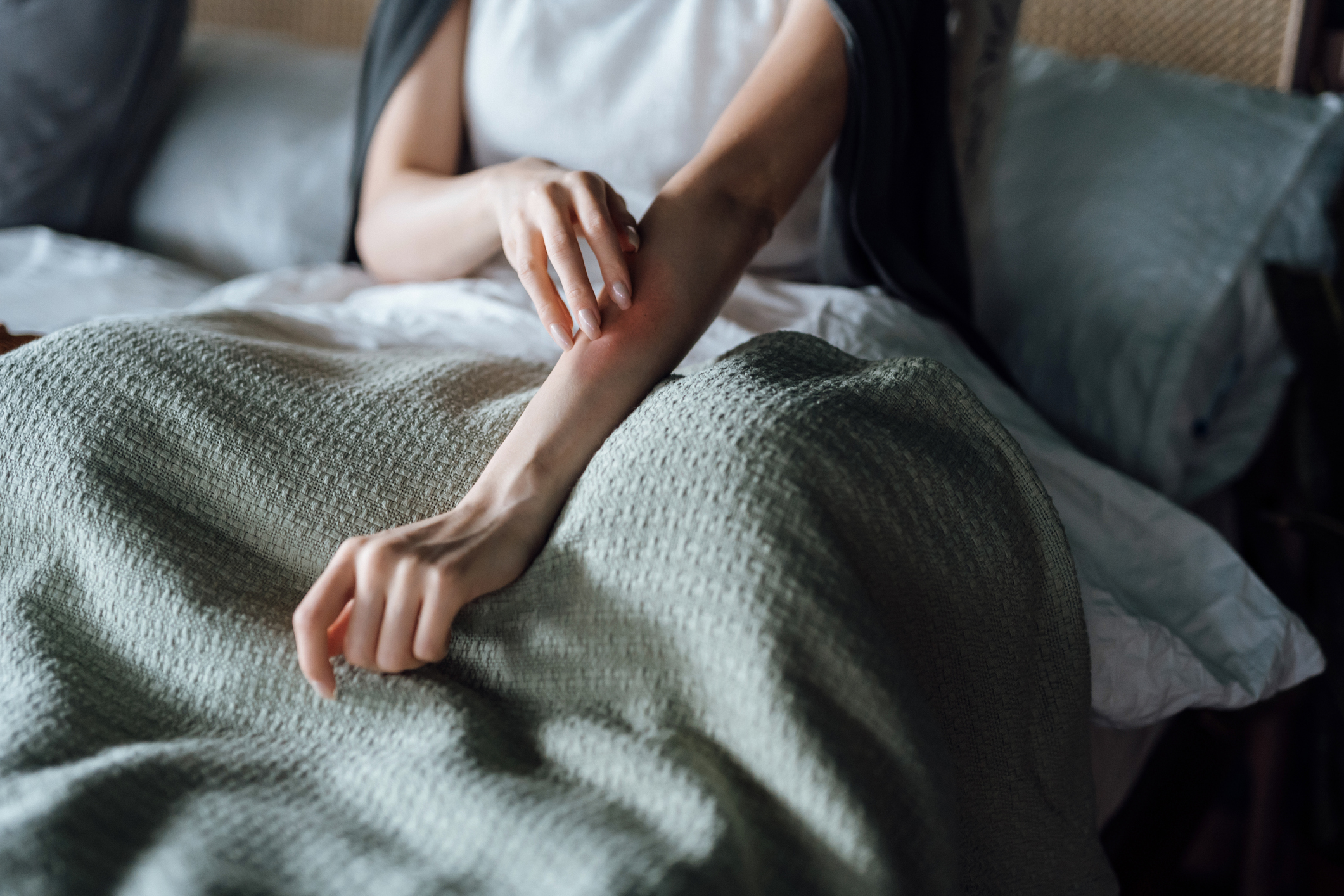 anxiety rash and mental health treatment in washington state